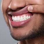 a north legon resident displaying his healed bleeding gum