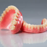 dental implants vs dentures in Ghana