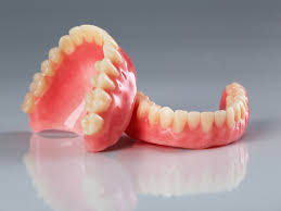 dental implants vs dentures in Ghana
