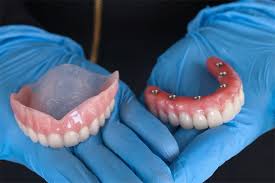 dental implants vs dentures akcess dental