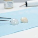 dental veneers in accra