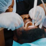 tooth filling cost ghana